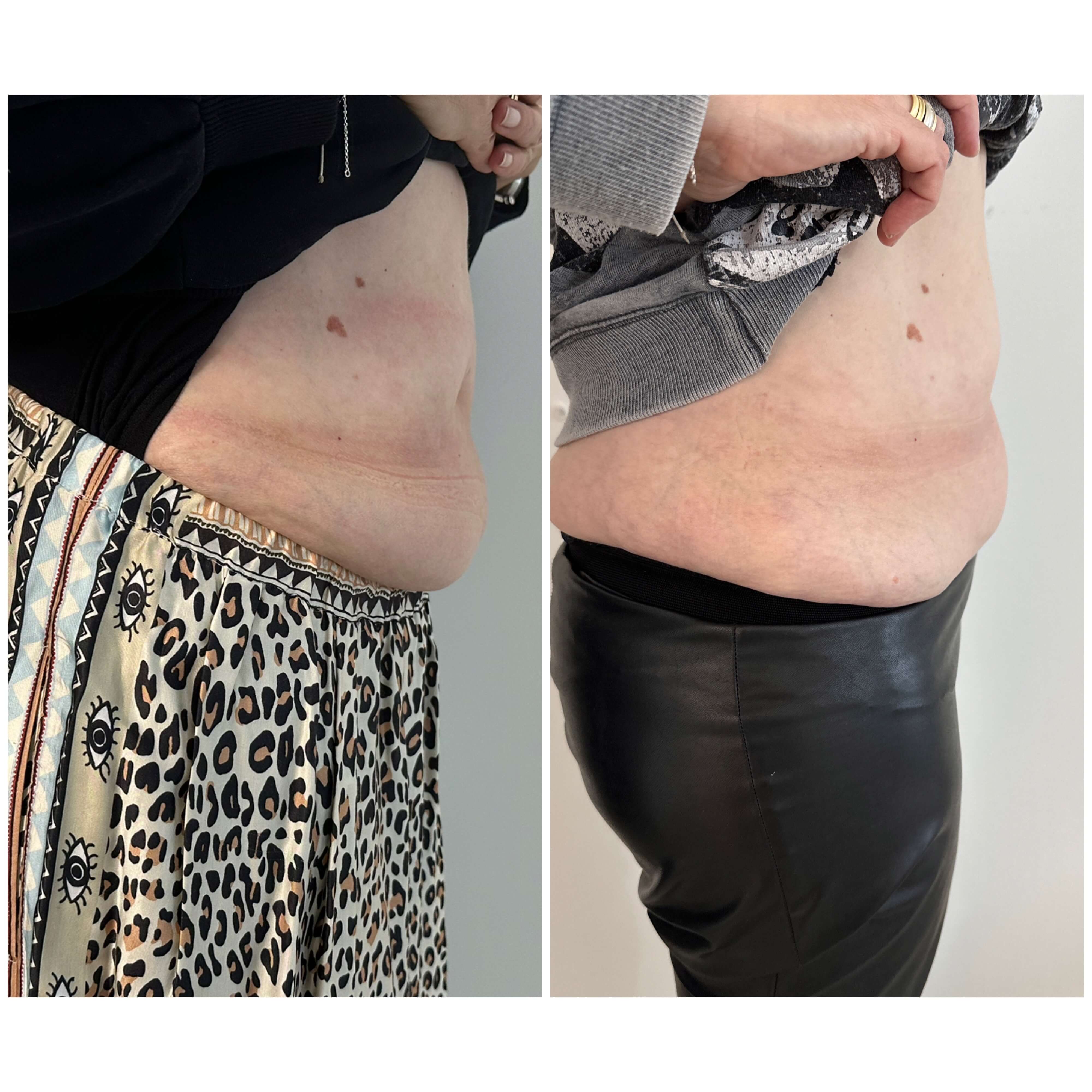 Before and After Lemon bottle