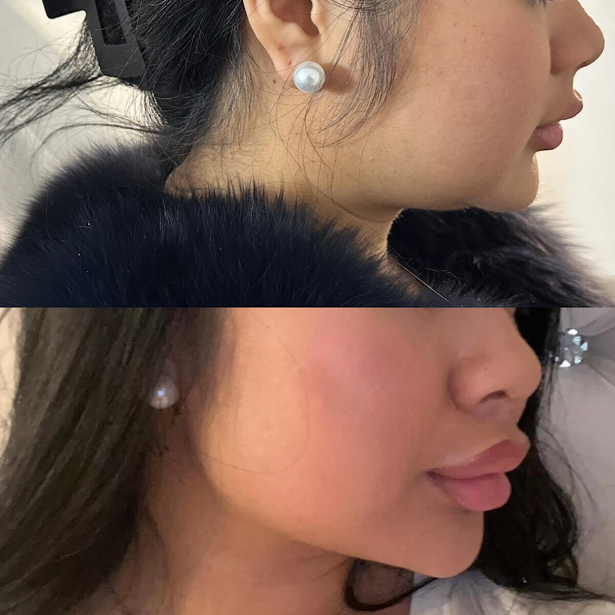 Before and After Lemon bottle